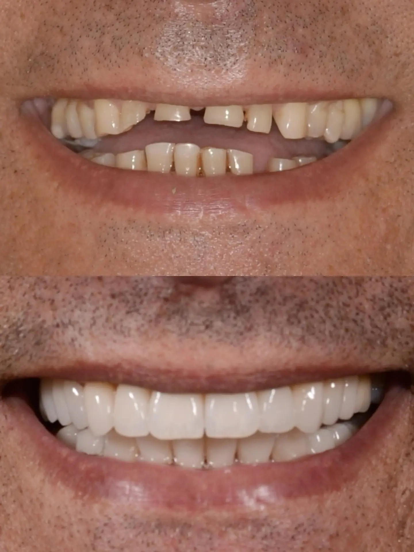 Dentes 2